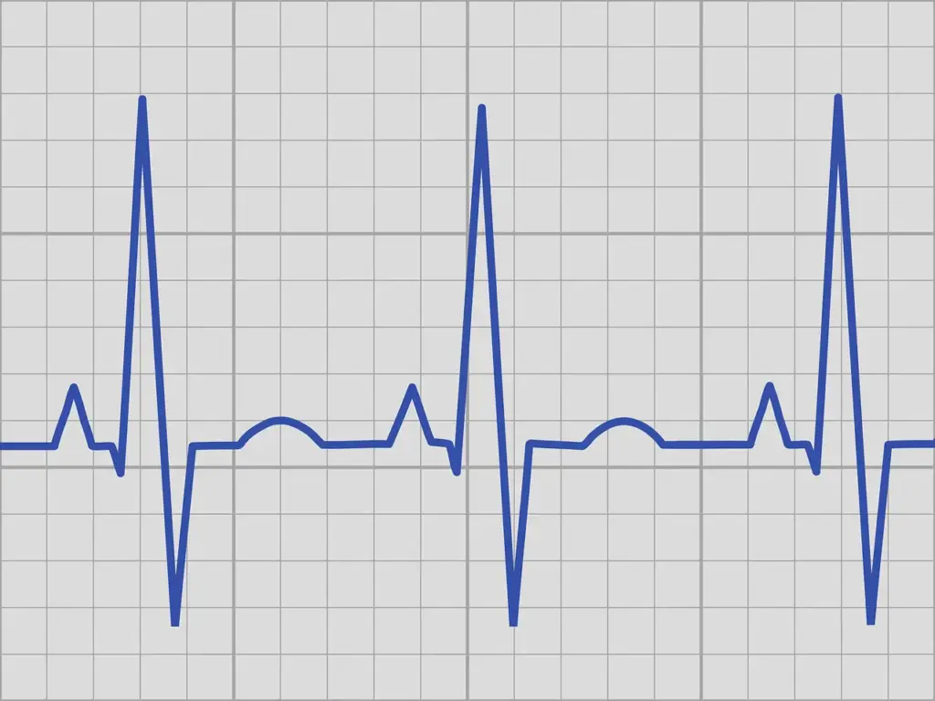 Herzratenvariabilität EKG